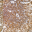 Immunohistochemistry analysis of KHSRP in paraffin-embedded mouse spleen tissue using KHSRP Rabbit mAb (STJ11102419) at a dilution of 1:200 (40x lens). High pressure antigen retrieval was performed with 0. 01 M citrate buffer (pH 6. 0) prior to immunohistochemistry staining.