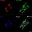 Immunohistochemistry analysis of paraffin-embedded Human lung tissue using TARBP2 Rabbit mAb  (STJ11102424) at a dilution of 1:200 (40x lens).  High pressure antigen retrieval was performed with 0. 01 M citrate buffer (pH 6. 0) prior to immunohistochemistry staining.