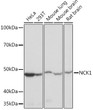 Western blot analysis of various lysates using NCK11 Rabbit mAb (STJ11102430) at 1:1000 dilution. <br/>Secondary antibody: HRP-conjugated Goat anti-Rabbit IgG (H+L) (STJS000856) at 1:10000 dilution. <br/>Lysates/proteins: 25 Mu g per lane. <br/>Blocking buffer: 3% nonfat dry milk in TBST. <br/>Detection: ECL Basic Kit <br/>Exposure time: 1s.
