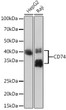 Western blot analysis of various lysates using CD74 Rabbit mAb (STJ11102439) at 1:1000 dilution. <br/>Secondary antibody: HRP-conjugated Goat anti-Rabbit IgG (H+L) (STJS000856) at 1:10000 dilution. <br/>Lysates/proteins: 25 Mu g per lane. <br/>Blocking buffer: 3% nonfat dry milk in TBST. <br/>Detection: ECL Basic Kit <br/>Exposure time: 90s.