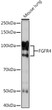 Western blot analysis of lysates from Mouse lung, using FGFR4 Rabbit mAb (STJ11102453) at 1:1000 dilution. <br/>Secondary antibody: HRP-conjugated Goat anti-Rabbit IgG (H+L) (STJS000856) at 1:10000 dilution. <br/>Lysates/proteins: 25 Mu g per lane. <br/>Blocking buffer: 3% nonfat dry milk in TBST. <br/>Detection: ECL Enhanced Kit <br/>Exposure time: 3min.