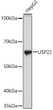 Western blot analysis of lysates from HepG2 cells, using USP22 Rabbit mAb (STJ11102464) at 1:1000 dilution. <br/>Secondary antibody: HRP-conjugated Goat anti-Rabbit IgG (H+L) (STJS000856) at 1:10000 dilution. <br/>Lysates/proteins: 25 Mu g per lane. <br/>Blocking buffer: 3% nonfat dry milk in TBST. <br/>Detection: ECL Basic Kit <br/>Exposure time: 1s.