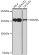 Western blot analysis of various lysates using KDM4A Rabbit mAb (STJ11102468) at 1:1000 dilution. <br/>Secondary antibody: HRP-conjugated Goat anti-Rabbit IgG (H+L) (STJS000856) at 1:10000 dilution. <br/>Lysates/proteins: 25 Mu g per lane. <br/>Blocking buffer: 3% nonfat dry milk in TBST. <br/>Detection: ECL Basic Kit <br/>Exposure time: 90s.