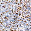 Immunohistochemistry analysis of paraffin-embedded Human tonsil using Fascin/FSCN1 Rabbit mAb (STJ11102495) at dilution of 1:100 (40x lens). Microwave antigen retrieval performed with 0. 01M Tris/EDTA Buffer (pH 9. 0) prior to immunohistochemistry staining.