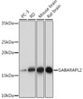 Western blot analysis of various lysates using GABARAPL2 Rabbit mAb (STJ11102498) at 1:1000 dilution. <br/>Secondary antibody: HRP-conjugated Goat anti-Rabbit IgG (H+L) (STJS000856) at 1:10000 dilution. <br/>Lysates/proteins: 25 Mu g per lane. <br/>Blocking buffer: 3% nonfat dry milk in TBST. <br/>Detection: ECL Basic Kit <br/>Exposure time: 10s.