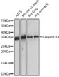 Western blot analysis of various lysates using Caspase-14 Rabbit mAb (STJ11102507) at 1:1000 dilution. <br/>Secondary antibody: HRP-conjugated Goat anti-Rabbit IgG (H+L) (STJS000856) at 1:10000 dilution. <br/>Lysates/proteins: 25 Mu g per lane. <br/>Blocking buffer: 3% nonfat dry milk in TBST. <br/>Detection: ECL Enhanced Kit <br/>Exposure time: 10s.