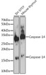 Western blot analysis of various lysates using Caspase-14 Rabbit mAb (STJ11102507) at 1:1000 dilution. <br/>Secondary antibody: HRP-conjugated Goat anti-Rabbit IgG (H+L) (STJS000856) at 1:10000 dilution. <br/>Lysates/proteins: 25 Mu g per lane. <br/>Blocking buffer: 3% nonfat dry milk in TBST. <br/>Detection: ECL Enhanced Kit <br/>Exposure time: 30s.