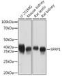 Western blot analysis of various lysates using SFRP1 Rabbit mAb (STJ11102518) at 1:1000 dilution. <br/>Secondary antibody: HRP-conjugated Goat anti-Rabbit IgG (H+L) (STJS000856) at 1:10000 dilution. <br/>Lysates/proteins: 25 Mu g per lane. <br/>Blocking buffer: 3% nonfat dry milk in TBST. <br/>Detection: ECL Basic Kit <br/>Exposure time: 10s.