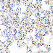 Immunohistochemistry analysis of paraffin-embedded Rat lung using TIRAP Rabbit mAb (STJ11102521) at dilution of 1:100 (40x lens). Microwave antigen retrieval performed with 0. 01M Tris/EDTA Buffer (pH 9. 0) prior to immunohistochemistry staining.