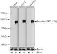 Western blot analysis of various lysates using Phospho-STAT1-Y701 Rabbit mAb (STJ11102552) at 1:1000 dilution incubated overnight at 4 °C. HeLa, NIH/3T3 and PC-12 cells were treated by TNF-Alpha (20 ng/ml) at 37 °C for 30 minutes. <br/>Secondary antibody: HRP-conjugated Goat anti-Rabbit IgG (H+L) (STJS000856) at 1:10000 dilution. <br/>Lysates/proteins: 30 Mu g per lane. <br/>Blocking buffer: 3% nonfat dry milk in TBST. <br/>Detection: ECL Basic Kit <br/>Exposure time: 20s.