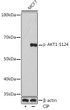 Western blot analysis of lysates from MCF7 cells, using Phospho-AKT1-S124 Rabbit mAb (STJ11102574) at 1:1000 dilution. MCF7 cells were treated by CIP (20uL/400ul) at 37 °C for 1 hour. <br/>Secondary antibody: HRP-conjugated Goat anti-Rabbit IgG (H+L) (STJS000856) at 1:10000 dilution. <br/>Lysates/proteins: 25 Mu g per lane. <br/>Blocking buffer: 3% BSA. <br/>Detection: ECL Basic Kit <br/>Exposure time: 3min.