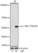 Western blot analysis of lysates from C6 cells, using Phospho-c-Myc-T58/S62 Rabbit mAb (STJ11102579) at 1:1000 dilution. C6 cells were treated by CIP (20uL/400ul) at 37 °C for 1 hour. <br/>Secondary antibody: HRP-conjugated Goat anti-Rabbit IgG (H+L) (STJS000856) at 1:10000 dilution. <br/>Lysates/proteins: 25 Mu g per lane. <br/>Blocking buffer: 3% BSA. <br/>Detection: ECL Basic Kit <br/>Exposure time: 10s.