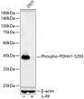 Western blot analysis of lysates from HeLa cells, using Phospho-PDHA1-S293 Rabbit mAb (STJ11102604) at1:23000 dilution. NIH/3T3 cells were treated by CIP (20uL/400ul) at 37 °C for 1 hour. <br/>Secondary antibody: HRP-conjugated Goat anti-Rabbit IgG (H+L) (STJS000856) at 1:10000 dilution. <br/>Lysates/proteins: 25 Mu g per lane. <br/>Blocking buffer: 3% nonfat dry milk in TBST. <br/>Detection: ECL Basic Kit <br/>Exposure time: 30s.