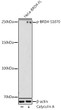 Western blot analysis of lysates from HeLa cells, using Phospho-BRD4-S1070 Rabbit pAb (STJ11102668) at 1:1000 dilution. HeLa cells were treated by Calyculin A (100 nM) at 37 °C for 30 minutes after serum-starvation overnight. <br/>Secondary antibody: HRP-conjugated Goat anti-Rabbit IgG (H+L) (STJS000856) at 1:10000 dilution. <br/>Lysates/proteins: 25 Mu g per lane. <br/>Blocking buffer: 3% nonfat dry milk in TBST. <br/>Detection: ECL Enhanced Kit <br/>Exposure time: 180s.