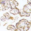Immunohistochemistry analysis of paraffin-embedded human placenta using FLT1 antibody (STJ111066) at dilution of 1:100 (40x lens). Perform microwave antigen retrieval with 10 mM PBS buffer pH 7. 2 before commencing with immunohistochemistry staining protocol.