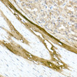 Immunohistochemistry analysis of paraffin-embedded rat stomach using Collagen I/COL1A1 rabbit polyclonal antibody (STJ111079) at dilution of 1:100 (40x lens). Perform microwave antigen retrieval with 10 mM PBS buffer pH 7. 2 before commencing with immunohistochemistry staining protocol.