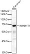 Western blot analysis of Rat brain, using RUNX1T1 antibody (STJ111109) at 1:600 dilution. Secondary antibody: HRP Goat Anti-Rabbit IgG (H+L) (STJS000856) at 1:10000 dilution. Lysates/proteins: 25 Mu g per lane. Blocking buffer: 3% nonfat dry milk in TBST. Detection: ECL Basic Kit. Exposure time: 60s.