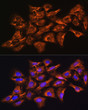 Immunofluorescence analysis of U-2 OS cells using GNB1 Rabbit polyclonal antibody (STJ111116) at dilution of 1:100 (40x lens). Blue: DAPI for nuclear staining.