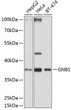Western blot analysis of extracts of various cell lines, using GNB1 antibody (STJ111116) at 1:1000 dilution. Secondary antibody: HRP Goat Anti-Rabbit IgG (H+L) (STJS000856) at 1:10000 dilution. Lysates/proteins: 25 Mu g per lane. Blocking buffer: 3% nonfat dry milk in TBST. Detection: ECL Basic Kit. Exposure time: 5s.