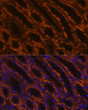 Immunofluorescence analysis of paraffin-embedded rat kidney using LAMC2 Rabbit polyclonal antibody (STJ111117) at dilution of 1:100 (40x lens). Secondary antibody: Cy3 Goat Anti-Rabbit IgG (H+L) at 1:500 dilution. Blue: DAPI for nuclear staining.