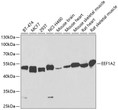Western blot analysis of extracts of various cell lines, using EEF1A2 antibody (STJ111156) at 1:1000 dilution. Secondary antibody: HRP Goat Anti-Rabbit IgG (H+L) (STJS000856) at 1:10000 dilution. Lysates/proteins: 25 Mu g per lane. Blocking buffer: 3% nonfat dry milk in TBST. Detection: ECL Basic Kit. Exposure time: 90s.