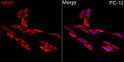 Immunofluorescence analysis of PC-12 cells using WNT1 Rabbit polyclonal antibody (STJ111158) at dilution of 1:200 (40x lens). Secondary antibody: Cy3 Goat Anti-Rabbit IgG (H+L) at 1:500 dilution. Blue: DAPI for nuclear staining.
