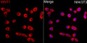 Immunofluorescence analysis of NIH/3T3 cells using WNT1 Rabbit polyclonal antibody (STJ111158) at dilution of 1:200 (40x lens). Secondary antibody: Cy3 Goat Anti-Rabbit IgG (H+L) at 1:500 dilution. Blue: DAPI for nuclear staining.