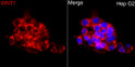 Immunofluorescence analysis of HepG2 cells using WNT1 Rabbit polyclonal antibody (STJ111158) at dilution of 1:200 (40x lens). Secondary antibody: Cy3 Goat Anti-Rabbit IgG (H+L) at 1:500 dilution. Blue: DAPI for nuclear staining.