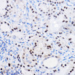 Western blot analysis of extracts of various cell lines, using SOX9 antibody (STJ111160) at 1:1000 dilution. Secondary antibody: HRP Goat Anti-rabbit IgG (H+L) at 1:10000 dilution. Lysates/proteins: 25ug per lane. Blocking buffer: 3% non-fat dry milk in TBST. Detection: ECL Basic Kit. Exposure time: 120s.