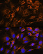 Western blot analysis of various lysates using AQP8 Rabbit pAb (STJ111278) at 1:1000 dilution. <br> Secondary antibody:HRP Goat Anti-Rabbit IgG (H+L) (STJS000856) at 1:10000 dilution. <br> Lysates/ proteins: 25 Mu g per lane. <br> Blocking buffer: 3 % nonfat dry milk in TBST. <br> Detection:ECL Basic Kit <br> Exposuretime: 90s.