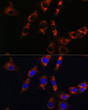 Immunofluorescence analysis of NIH/3T3 cells using AQP8 Rabbit pAb (STJ111278) at dilution of 1:100. Secondary antibody: Cy3 Goat Anti-Rabbit IgG (H+L) (STJS001166) at 1:500 dilution. Blue: DAPI for nuclear staining.