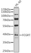 Western blot analysis of lysates from HL-60 cells, using FCGRT Rabbit pAb (STJ111283) at 1:1000 dilution. <br/>Secondary antibody: HRP-conjugated Goat anti-Rabbit IgG (H+L) (STJS000856) at 1:10000 dilution. <br/>Lysates/proteins: 25 Mu g per lane. <br/>Blocking buffer: 3% nonfat dry milk in TBST. <br/>Detection: ECL Basic Kit <br/>Exposure time: 30s.