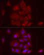 Immunofluorescence analysis of A-549 cells using FCGRT Rabbit pAb (STJ111283) at dilution of 1:50 (40x lens). Secondary antibody: Cy3-conjugated Goat anti-Rabbit IgG (H+L) (STJS001166) at 1:500 dilution. Blue: DAPI for nuclear staining.