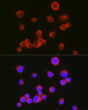 Immunofluorescence analysis of Neuro-2a cells using CD171/L1CAM Rabbit pAb (STJ111291) at dilution of 1:100 (40x lens). Secondary antibody: Cy3-conjugated Goat anti-Rabbit IgG (H+L) (STJS001166) at 1:500 dilution. Blue: DAPI for nuclear staining.