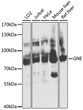 Western blot analysis of various lysates using GNE Rabbit pAb (STJ111305) at 1:1000 dilution. <br/>Secondary antibody: HRP-conjugated Goat anti-Rabbit IgG (H+L) (STJS000856) at 1:10000 dilution. <br/>Lysates/proteins: 25 Mu g per lane. <br/>Blocking buffer: 3% nonfat dry milk in TBST. <br/>Detection: ECL Basic Kit <br/>Exposure time: 10s.