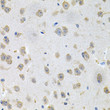 Immunohistochemistry analysis of paraffin-embedded Mouse brain using GNE Rabbit pAb (STJ111305) at dilution of 1:100 (40x lens). Microwave antigen retrieval performed with 0. 01M PBS Buffer (pH 7. 2) prior to immunohistochemistry staining.