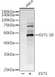 Western blot analysis of various lysates using (STJ111339) at 1:1000 dilution. <br/>Secondary antibody: HRP-conjugated Goat anti-Rabbit IgG (H+L) (STJS000856) at 1:10000 dilution. <br/>Lysates/proteins: 25 Mu g per lane. <br/>Blocking buffer: 3% nonfat dry milk in TBST. <br/>Detection: ECL Basic Kit <br/>Exposure time: 0. 5s. Western blot analysis of various lysates using (STJ111339) at 1:1000 dilution. <br/>Secondary antibody: HRP-conjugated Goat anti-Rabbit IgG (H+L) (STJS000856) at 1:10000 dilution. <br/>Lysates/proteins: 25 Mu g per lane. <br/>Blocking buffer: 3% nonfat dry milk in TBST. <br/>Detection: ECL Basic Kit <br/>Exposure time: 0. 5s.