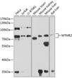 Western blot analysis of various lysates using MTMR2 Rabbit pAb (STJ111510) at 1:1000 dilution. <br/>Secondary antibody: HRP-conjugated Goat anti-Rabbit IgG (H+L) (STJS000856) at 1:10000 dilution. <br/>Lysates/proteins: 25 Mu g per lane. <br/>Blocking buffer: 3% nonfat dry milk in TBST. <br/>Detection: ECL Basic Kit <br/>Exposure time: 30s.