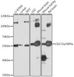 Western blot analysis of various lysates using CD172a/SIRP Alpha Rabbit pAb (STJ111516) at 1:1000 dilution. <br/>Secondary antibody: HRP-conjugated Goat anti-Rabbit IgG (H+L) (STJS000856) at 1:10000 dilution. <br/>Lysates/proteins: 25 Mu g per lane. <br/>Blocking buffer: 3% nonfat dry milk in TBST. <br/>Detection: ECL Basic Kit <br/>Exposure time: 1s.