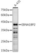 Western blot analysis of lysates from A-431 cells, using EBNA1BP2 Rabbit pAb (STJ111587) at 1:1000 dilution. <br/>Secondary antibody: HRP-conjugated Goat anti-Rabbit IgG (H+L) (STJS000856) at 1:10000 dilution. <br/>Lysates/proteins: 25 Mu g per lane. <br/>Blocking buffer: 3% nonfat dry milk in TBST. <br/>Detection: ECL Basic Kit <br/>Exposure time: 30s.