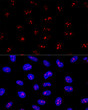 Confocal immunofluorescence analysis of U2OS cells using EBNA1BP2 Rabbit pAb (STJ111587) at dilution of 1:200. Blue: DAPI for nuclear staining.