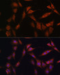 Immunofluorescence analysis of C6 cells using PFKFB2 Rabbit pAb (STJ111650) at dilution of 1:100 (40x lens). Secondary antibody: Cy3-conjugated Goat anti-Rabbit IgG (H+L) (STJS001166) at 1:500 dilution. Blue: DAPI for nuclear staining.
