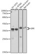 Western blot analysis of various lysates using SRR Rabbit pAb (STJ111657) at 1:3000 dilution. <br/>Secondary antibody: HRP-conjugated Goat anti-Rabbit IgG (H+L) (STJS000856) at 1:10000 dilution. <br/>Lysates/proteins: 25 Mu g per lane. <br/>Blocking buffer: 3% nonfat dry milk in TBST. <br/>Detection: ECL Basic Kit <br/>Exposure time: 60s.