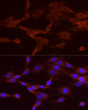 Immunofluorescence analysis of PC-12 cells using NUMB Rabbit pAb (STJ111671) at dilution of 1:200 (40x lens). Secondary antibody: Cy3-conjugated Goat anti-Rabbit IgG (H+L) (STJS001166) at 1:500 dilution. Blue: DAPI for nuclear staining.