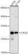 Western blot analysis of various lysates using Calretinin Rabbit pAb (STJ111849) at 1:1000 dilution. <br/>Secondary antibody: HRP-conjugated Goat anti-Rabbit IgG (H+L) (STJS000856) at 1:10000 dilution. <br/>Lysates/proteins: 25 Mu g per lane. <br/>Blocking buffer: 3% nonfat dry milk in TBST. <br/>Detection: ECL Basic Kit <br/>Exposure time: 30s.