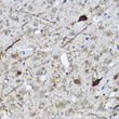 Immunohistochemistry analysis of paraffin-embedded Rat brain using Calretinin Rabbit pAb (STJ111849) at dilution of 1:100 (40x lens). High pressure antigen retrieval performed with 0. 01M Citrate Bufferr (pH 6. 0) prior to immunohistochemistry staining.