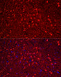 Immunofluorescence analysis of paraffin-embedded rat brain using Calretinin Rabbit pAb (STJ111849) at dilution of 1:200 (40x lens). Secondary antibody: Cy3-conjugated Goat anti-Rabbit IgG (H+L) (STJS001166) at 1:500 dilution. Blue: DAPI for nuclear staining.