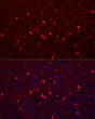 Immunofluorescence analysis of paraffin-embedded mouse brain using Calretinin Rabbit pAb (STJ111849) at dilution of 1:200 (40x lens). Secondary antibody: Cy3-conjugated Goat anti-Rabbit IgG (H+L) (STJS001166) at 1:500 dilution. Blue: DAPI for nuclear staining.