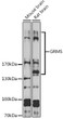 Western blot analysis of various lysates using G <br/>Secondary antibody: HRP-conjugated Goat anti-Rabbit IgG (H+L) (STJS000856) at 1:10000 dilution. <br/>Lysates/proteins: 25 Mu g per lane. <br/>Blocking buffer: 3% nonfat dry milk in TBST. <br/>Detection: ECL Basic Kit <br/>Exposure time: 1s.