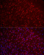 Immunofluorescence analysis of paraffin-embedded mouse brain using G Secondary antibody: Cy3-conjugated Goat anti-Rabbit IgG (H+L) (STJS001166) at 1:500 dilution. Blue: DAPI for nuclear staining.